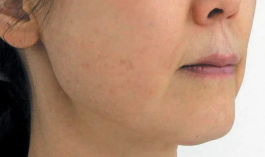 Oligio — Клиника эстетической медицины Major Beauty, г. Москва