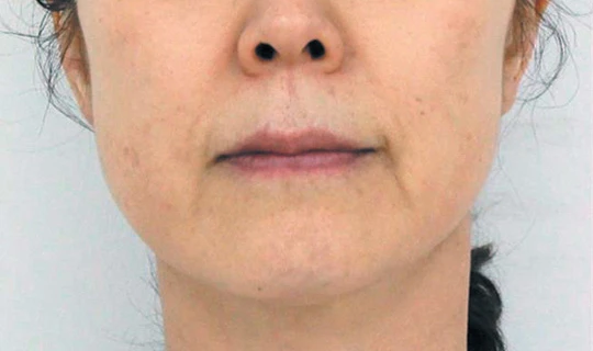 Oligio — Клиника эстетической медицины Major Beauty, г. Москва